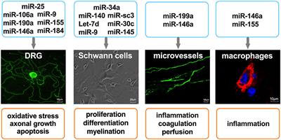 Emerging Roles of microRNAs as Biomarkers and Therapeutic Targets for Diabetic Neuropathy